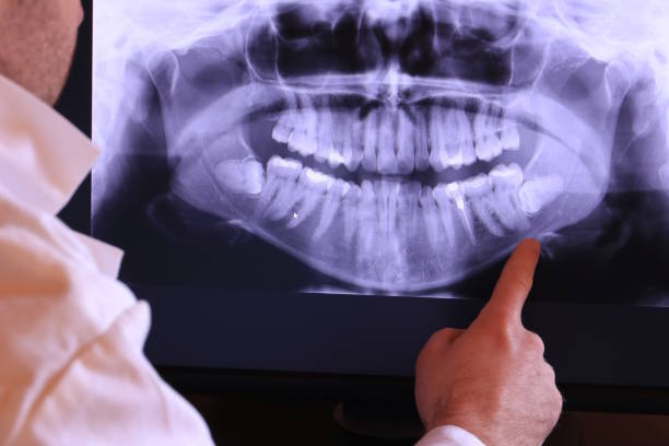 Best Emergency Dental Services Near Me  in Bel Air North, MD