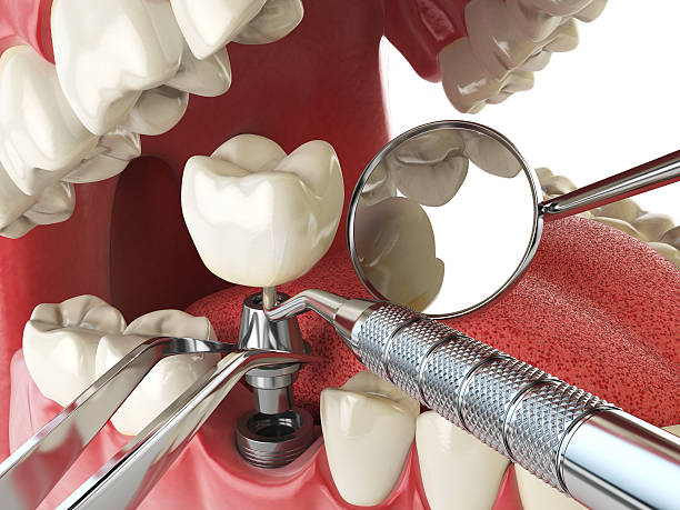 Best Broken Tooth Emergency  in Bel Air North, MD